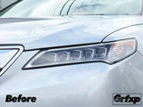 Headlight Overlays for Acura TLX (2015 – 2017)